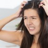 Reasons why People Experience Itchy Scalp and some Available treatments