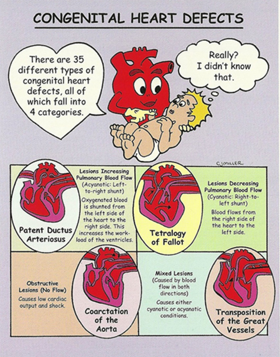 How I Care for My CHD Heart Baby (and Take Care of Myself ...