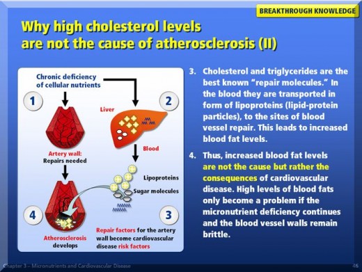 The cholesterol myth