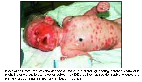 a newborn baby in Africa dying of HIV 