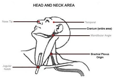 These are pressure points in the head that most martial artists know about. What maybe less known is that three of these can lead to death or severe bodily damage for which there maybe legal questions: cranium, brachial plexus origin, jugular notch