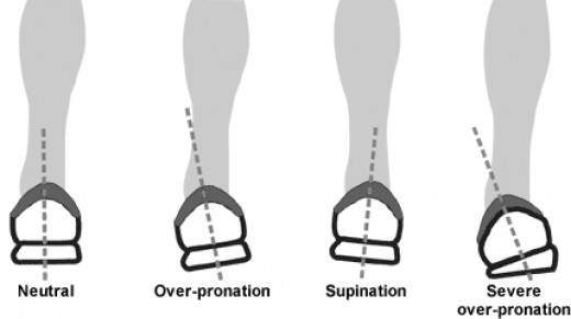 best shoes to correct pronation