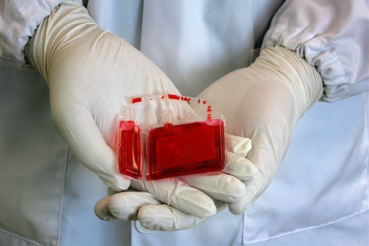 Cord blood banking issue is surrounded by a lot of hype and misunderstanding.