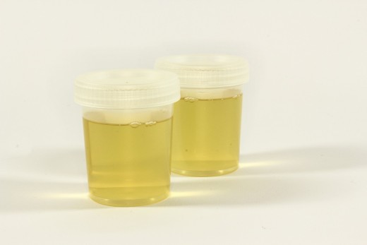 Urine colour to indicate hydration levels.