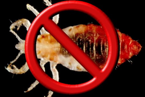Eliminating Head Lice When Prescription Treatments Fail Eliminating Head Lice When Prescription Treatments Fail
