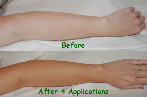 Before and After Pictures