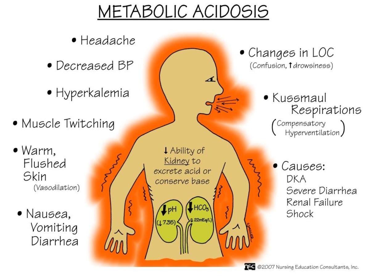 General symptoms of acidosis. These usually accompany symptoms of another primary defect (respiratory or metabolic).