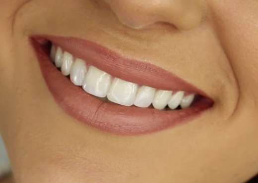 Bright smile with white teeth