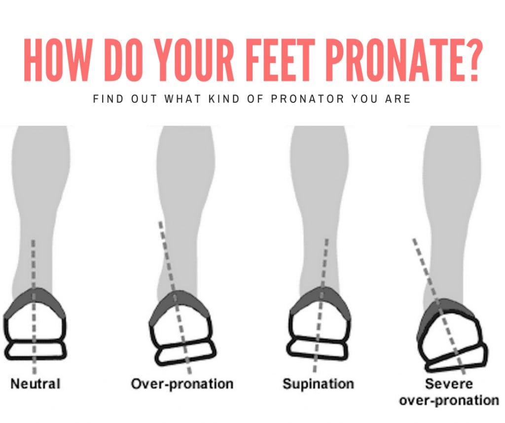 Find Your Foot Type (Pronator, Supinator, or Neutral) | HubPages