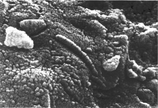 Tiny Martians? Some scientists believe these small structures found in a Martian meteorite, ALH84001, are fossilized microbes. 