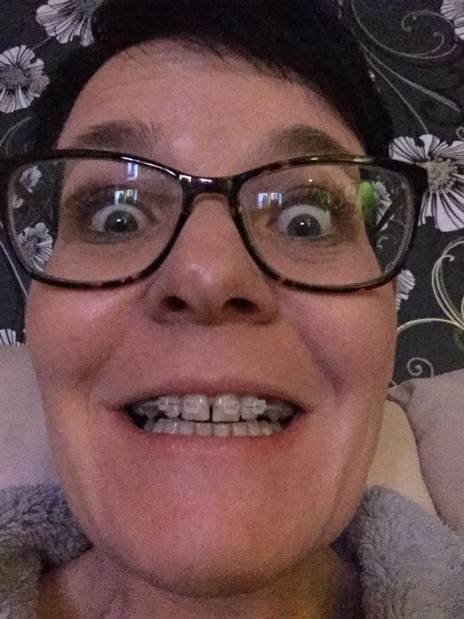 Braces on!