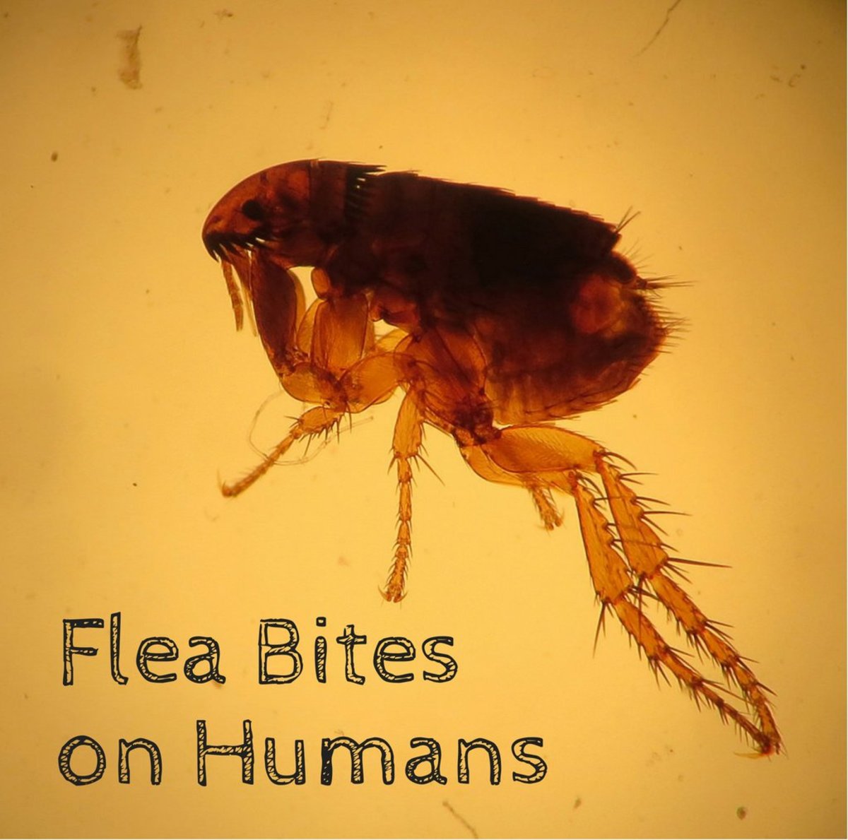 Flea Bites on Humans Symptoms and Treatment Dengarden