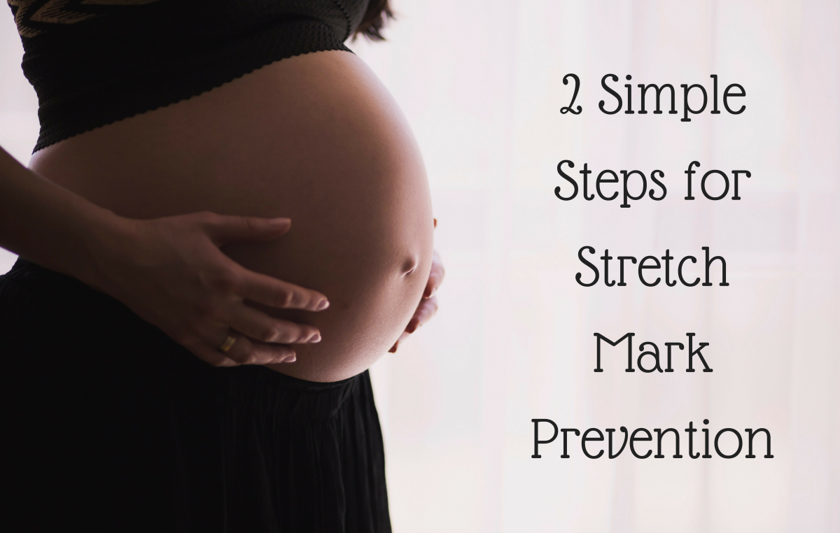 How to Prevent Stretch Marks During Pregnancy | Bellatory