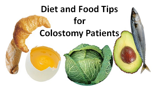 My Colostomy Diet And Food Tips For Stoma Patients | Patient's Lounge