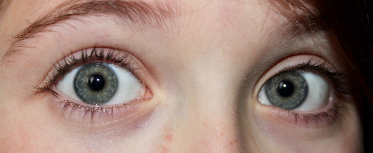 Grey eyes have more collagen in the stroma than blue eyes, which changes the way light scatters and reflects grey rather than blue.