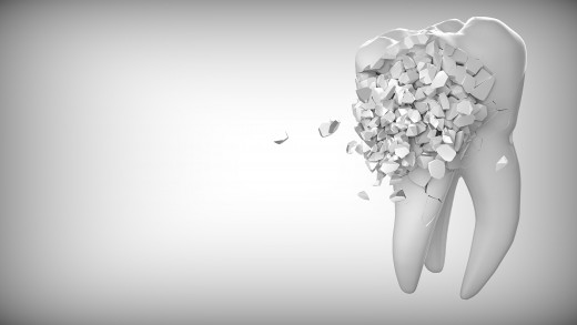 What Do Dreams About Teeth Falling Out Mean? 6 Ways to Interpret Tooth