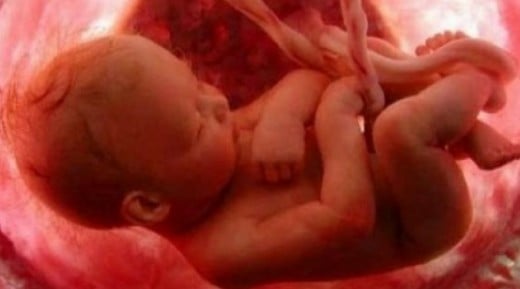 Late-term abortion causes agonizing pain to a fully developed human being before it dies.