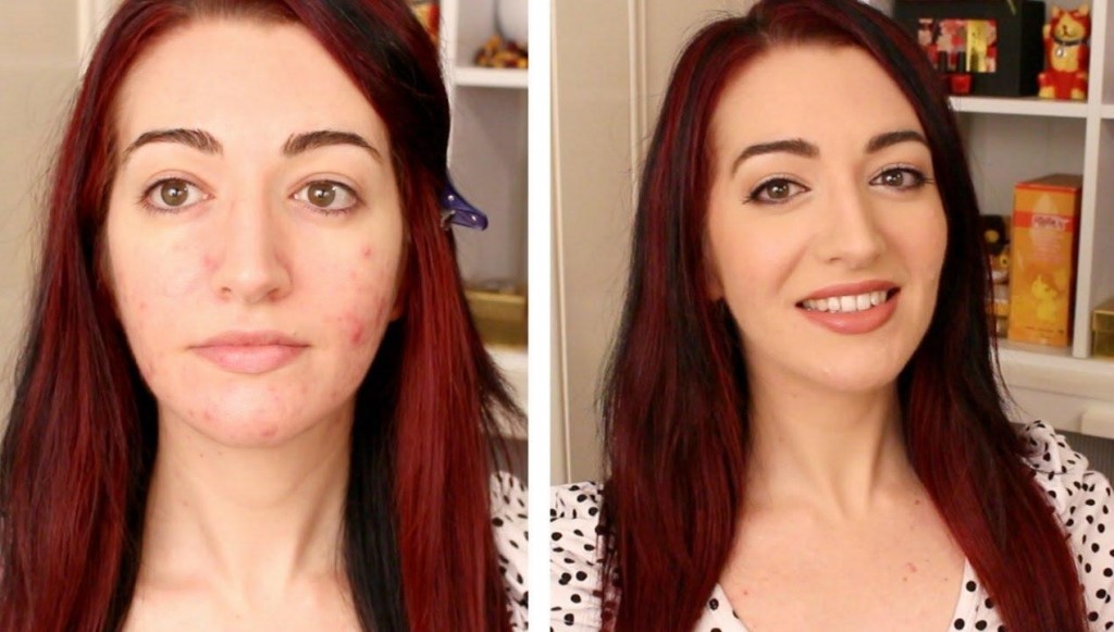makeup steps for acne prone skin