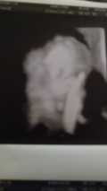Second Trimester Thoughts Weeks 14-26