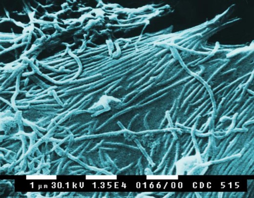 Ebola virus, enlarged with an electron microscope