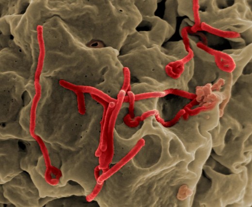Ebola Virus  Scanning electron micrograph of Ebola virus budding from the surface of a Vero cell (African green monkey kidney epithelial cell line). 