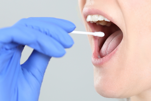 A DNA test usually involves a buccal swab