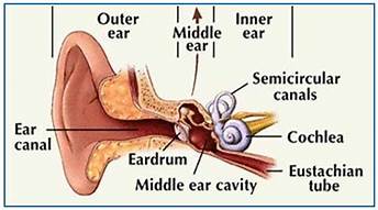 Are Cochlear Implants For You? | HubPages