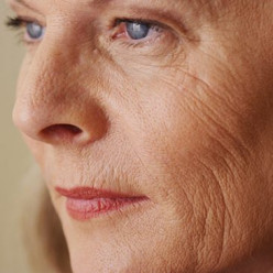 My Mom Used These Remedies for Her Wrinkles and Also Suggested to Me, Skin Care Part-02