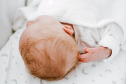 How To Get Rid Of Cradle Cap Fast
