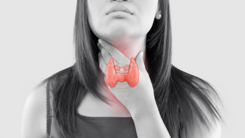 Medical condition such as thyroid can have an effect in premature graying.