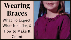 Wearing Braces - What To Expect, What It's Like, and How to Make It Count