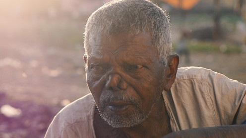 A man in India showing signs of leprosy.