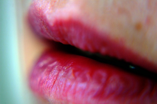 Photo Credit: http://www.flickr.com/photos/ 62337512@N00/3197812518/