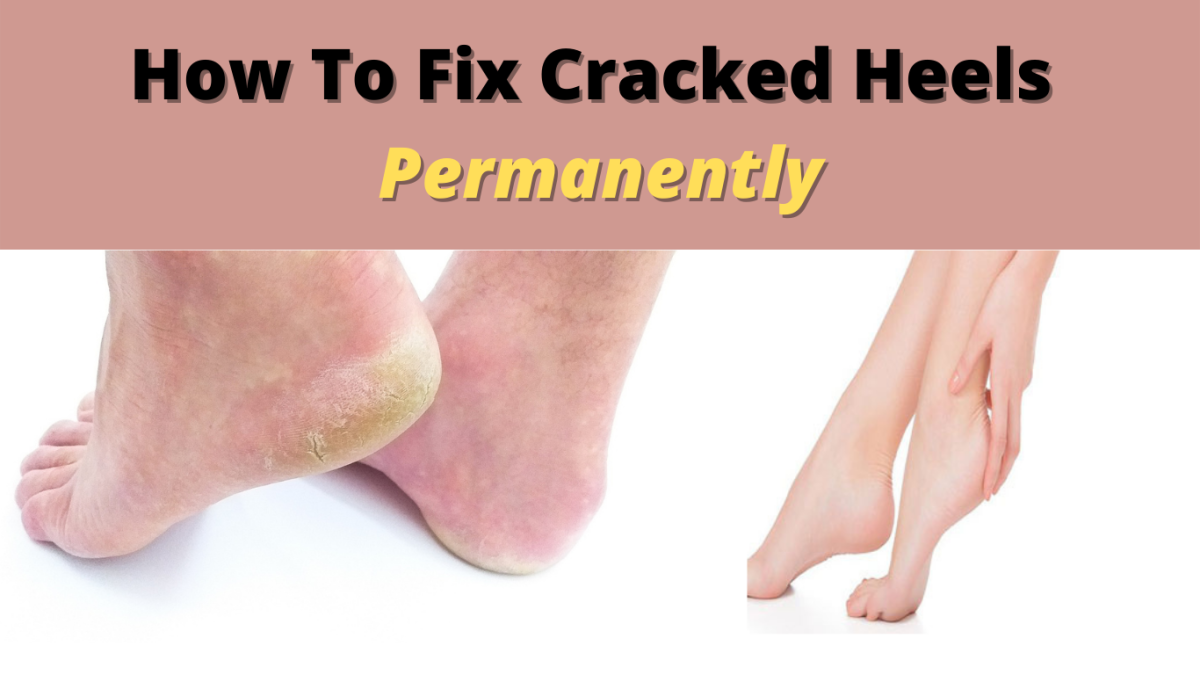 The ultimate guide to Fix Cracked Heels Permanently and Get Soft Feet at Home