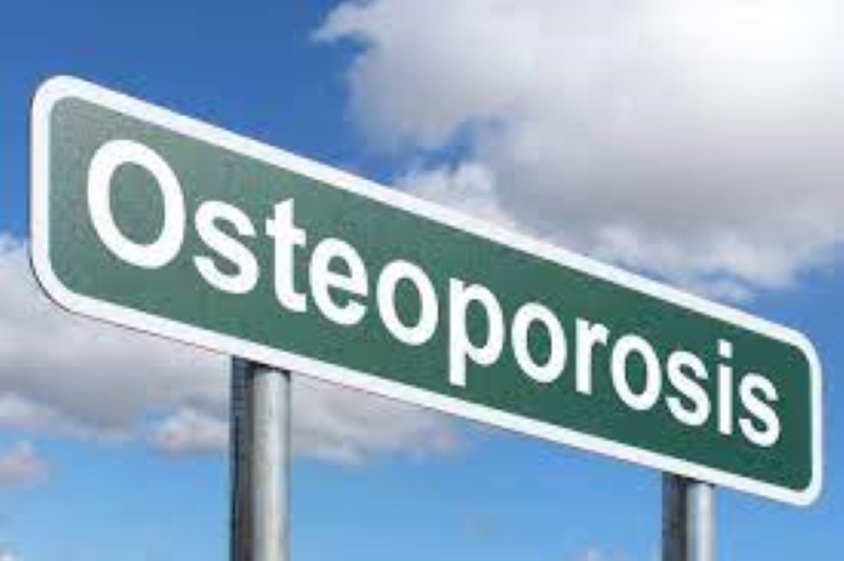 Is Osteoporosis Genetic? The Risks, the Factors, and What You Can Do