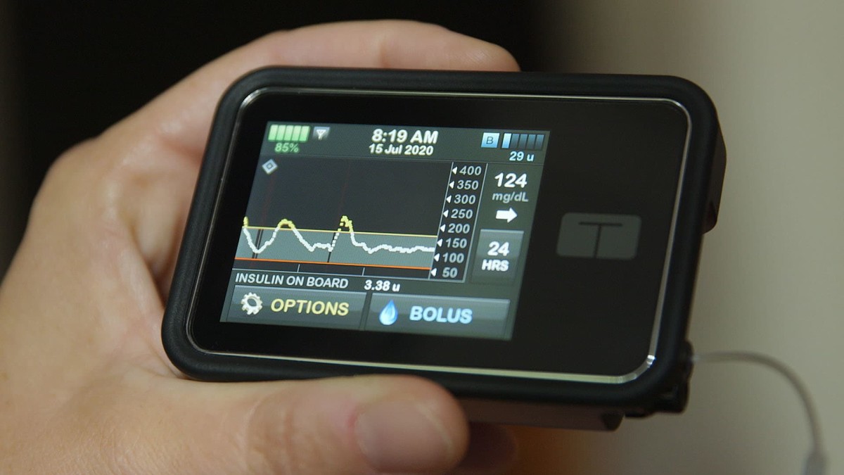 Insulin Pump and Continuous Glucose Monitor