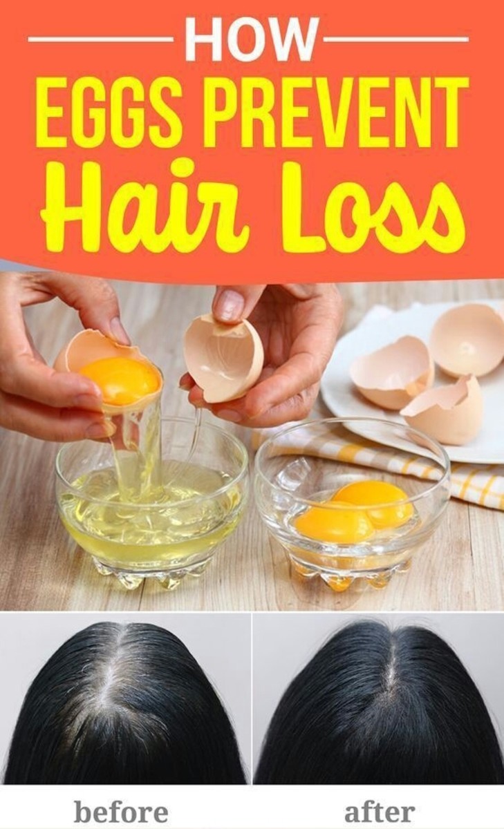 How Eggs Prevent Hair Loss