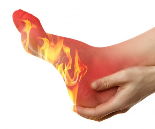 9 Causes of Hot Feet at Night and Remedies to Cool Down Burning Feet