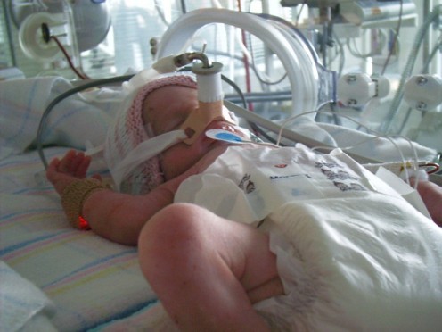 Preterm baby in an incubator