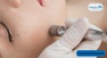 How to Remove Hair Facial at Home Using the Best Hair Removal Machine for Face
