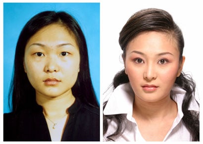 In before-and-after photo Hao Lulu's appearance was indeed radically altered, in particular her eyes, which were given double eyelids to give her a more occidental appearance. The color of her skin was also lightened.