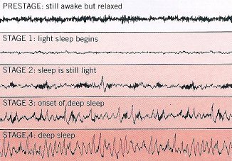 The stages of sleep recur in several cycles every night. Each stage has a distinctive brainwave pattern and the sequence and number of stages in a cycle vary.