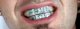 Iced Out Hip Hop Grill