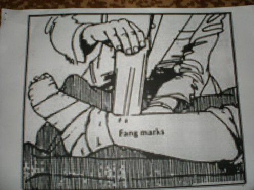 1. Apply a broad, firm bandage over the bite as soon as possible. Keep the bitten area still.