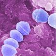 Streptococcus.        photo latimesblogs.com