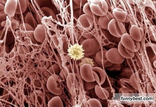 Red blood cells with white one in the middle - microscope photo