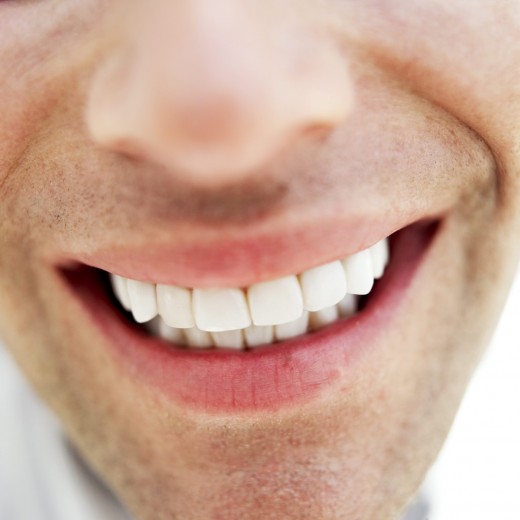 Teeth whitening solutions for a perfect smile