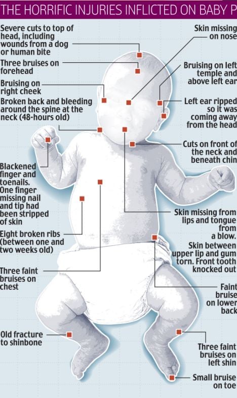 and the injuries inflicted by these people