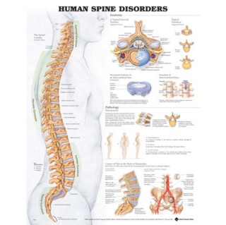For understanding the importance of artificial disc replacement, it is really important to understand the Anatomy of Human Spine and Role of Intervertebral Discs