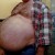 One of the worst beer guts I've ever seen, and this guy is in way too bad a shape for liposuction to help. One of the worst beer guts I've ever seen, and this guy is in way too bad a shape for liposuction to help.